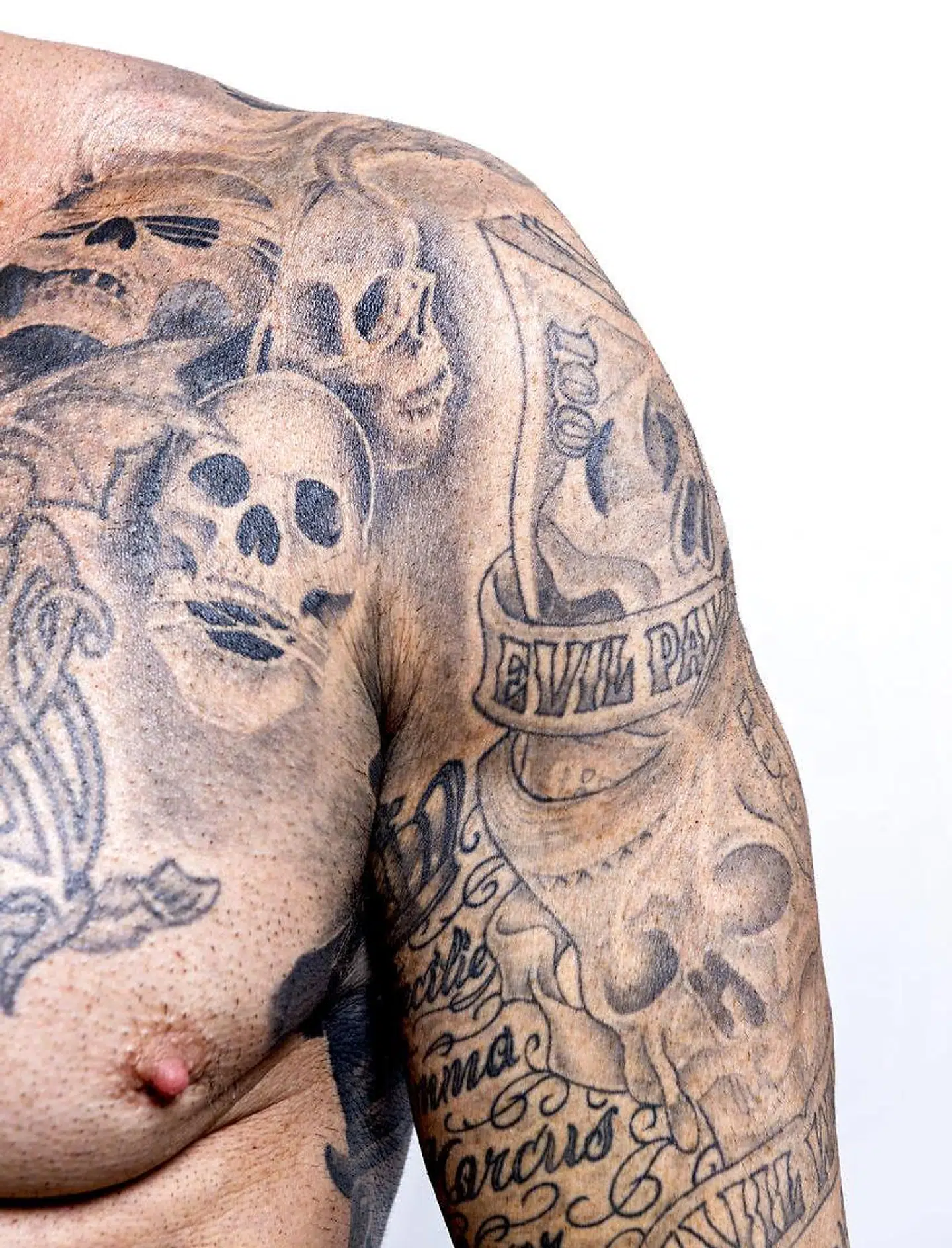 Kim Novaa, også kendt som 'Botoxkongen', har fået ekstra fedt i skuldre og biceps i forbindelse med operationen.