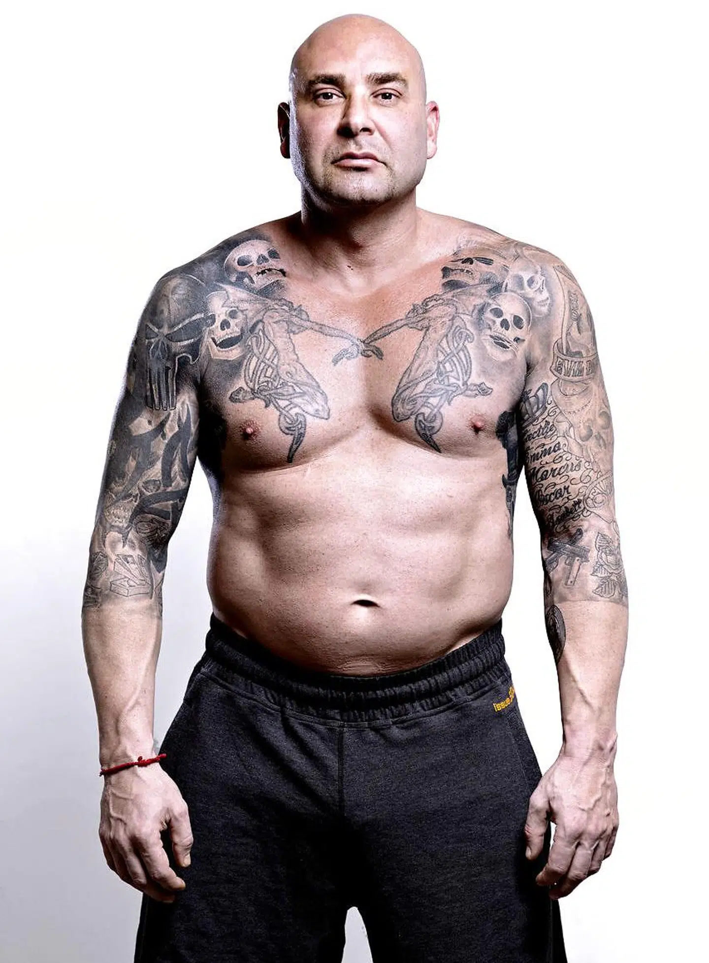 Kim Novaa, også kendt som Botox-kongen, tager til London for at få foretaget en meget omfattende skønhedsoperation. Her får han fjernet alt overskydende fedt på overkroppen og får pumpet det ind andre steder, så han vil fremstå mere trimmet og muskuløs. Dette er et før-billede, taget to dage før operationen.