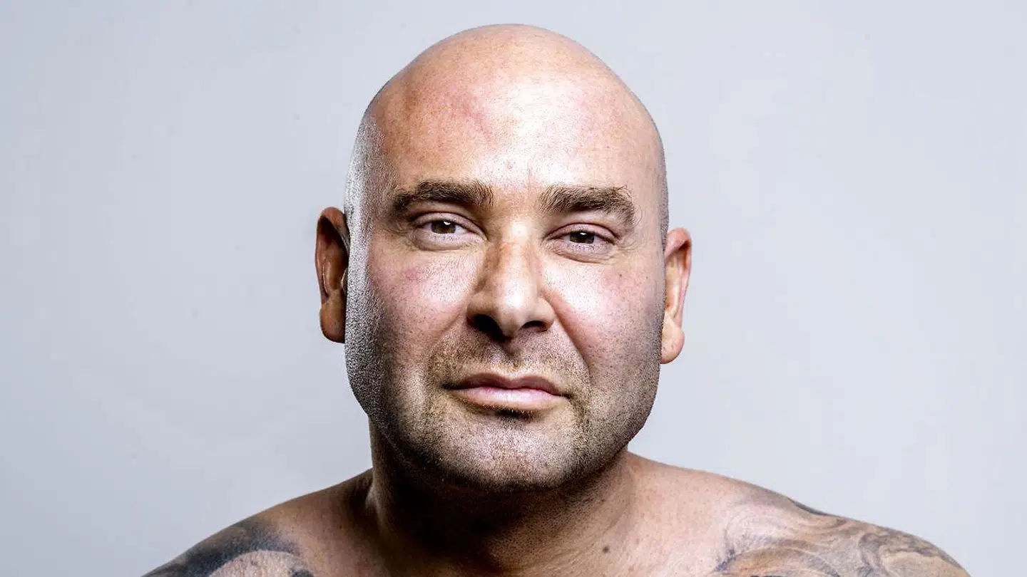 Kim Novaa er ikke tilfreds med sin krop. Derfor skal han nu opereres.