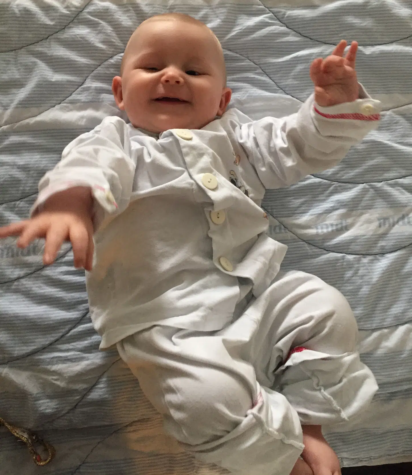 Lily får i april 2018 MR-scannet sin hjerne. Billederne viser sig af få afgørende betydning for Lilys diagnose. Foto: Privat.