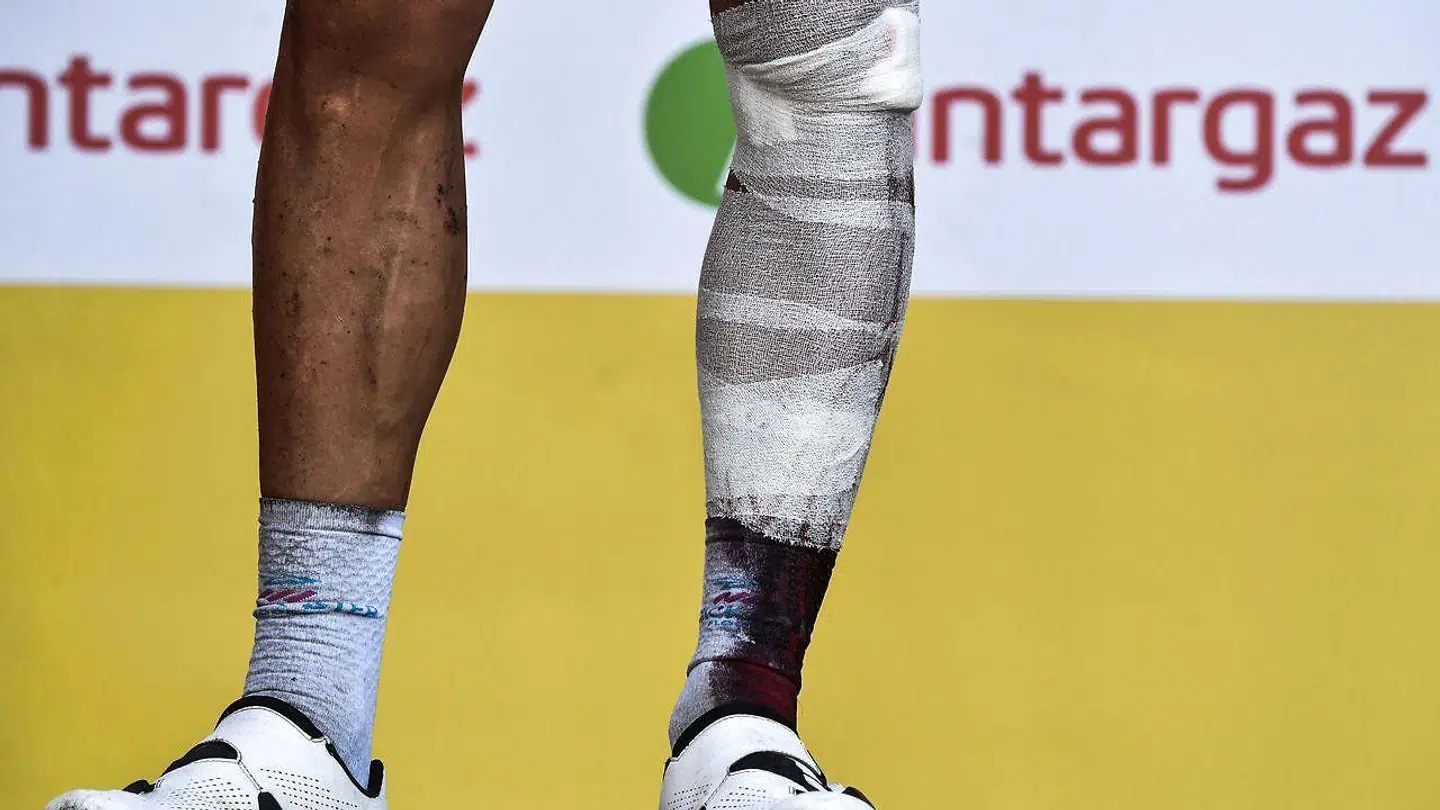 Philippe Gilberts ben efter styrtet.