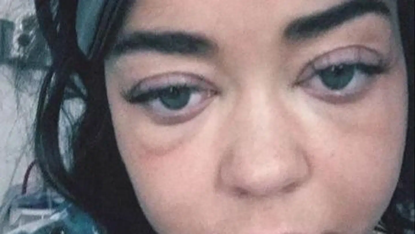 'Modern Family'-skuespilleren Sarah Hyland har delt et opsigtsvækkende billede af sig selv.