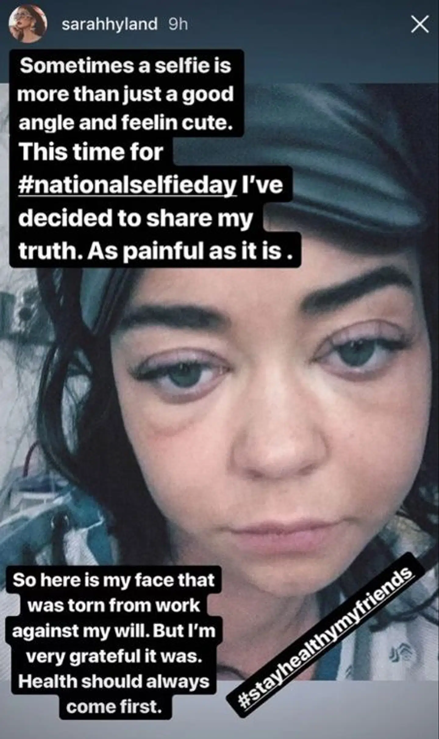 'Modern Family'-skuespilleren Sarah Hyland har delt et opsigtsvækkende billede af sig selv.