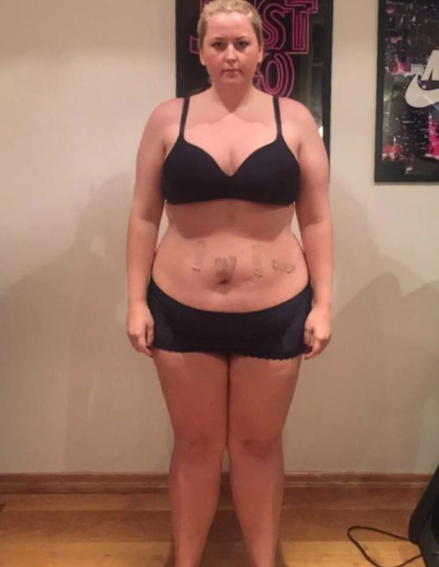 Sådan så Tina Charlott Nomedal LaFon ud før operationen i 2016.