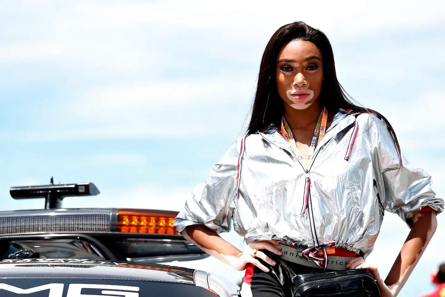 Winnie Harlow kom på alles læber efter Formel 1-løbet.