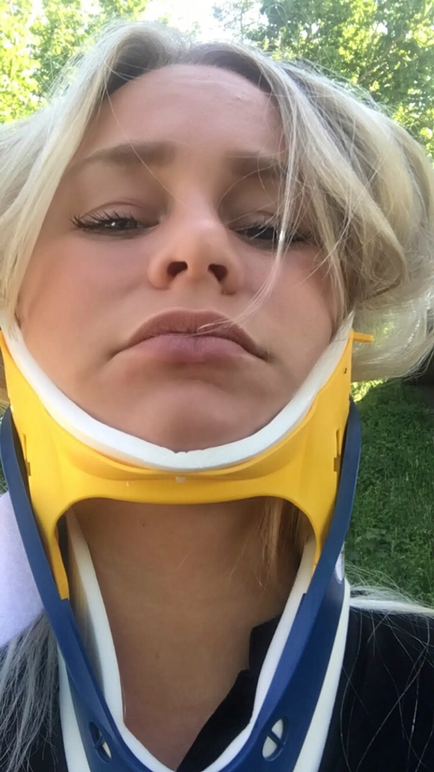 Kia Lilballe tog dette billede af sig selv umiddelbart efter ulykken.