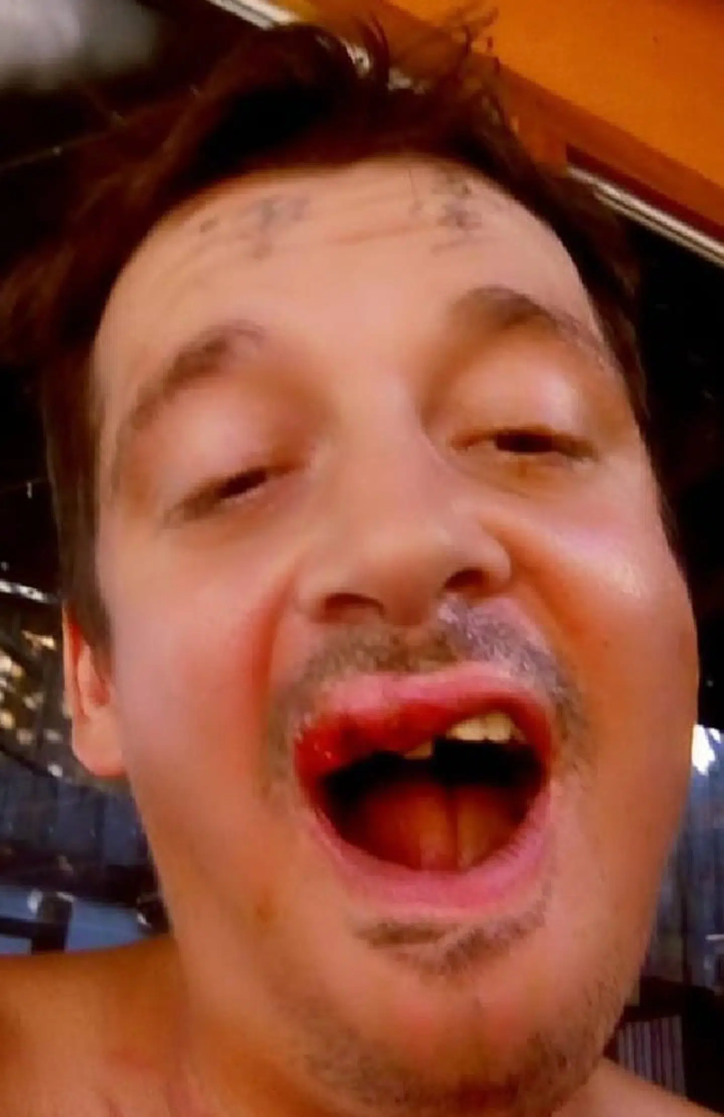 Paul Ferrell efter slagsmålet med ti fastlandskinesere.