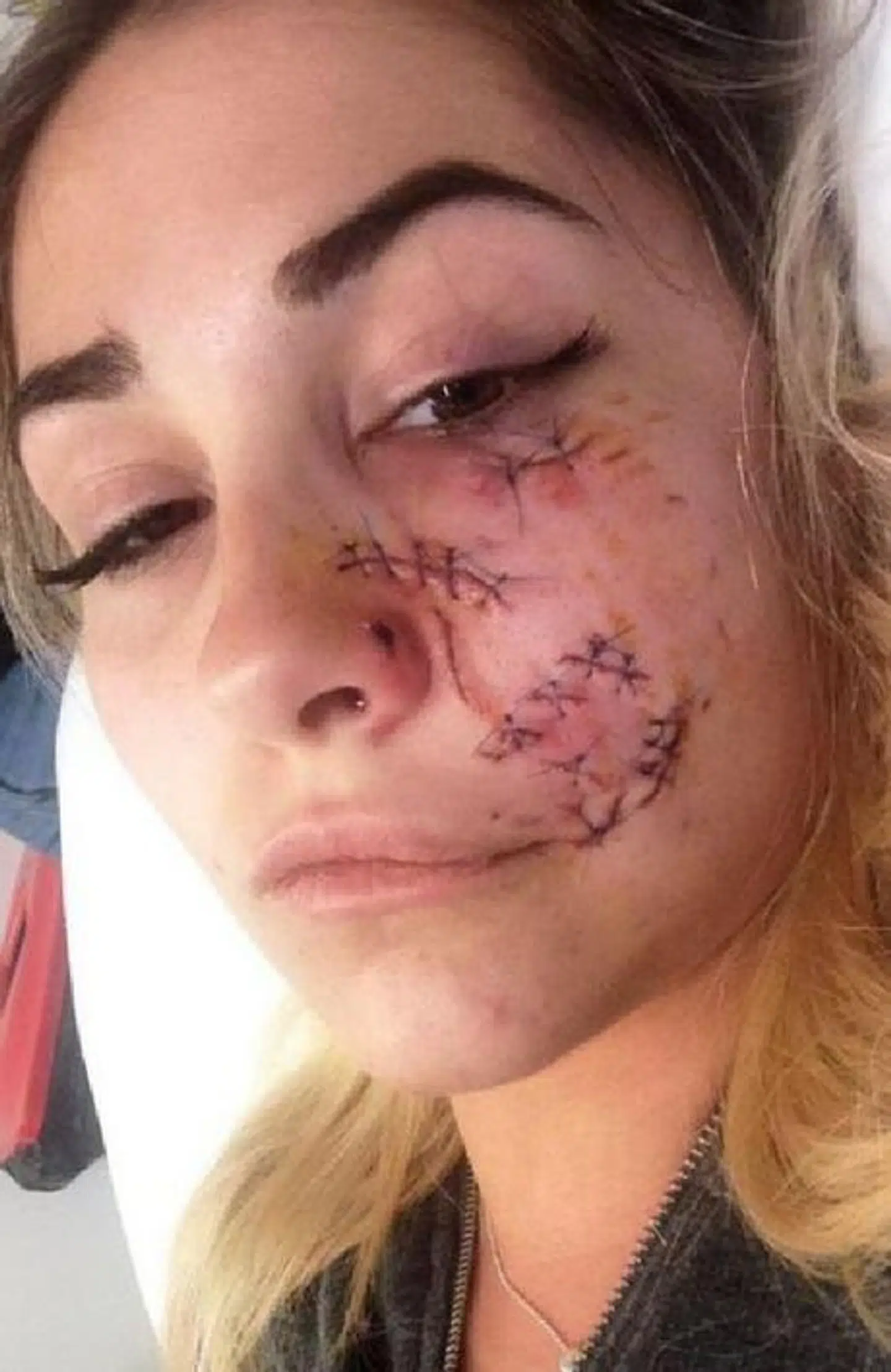 Det så temmeligt voldsomt ud efter hunden gik amok på hendes ansigt.