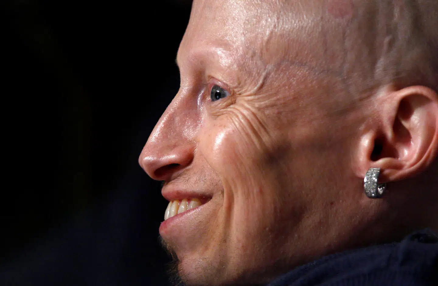 Verne Troyer er død. Han blev 49 år.