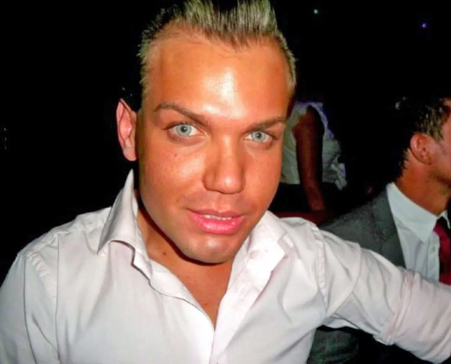 Sådan så han ud, inden indgrebene ændrede hans liv.