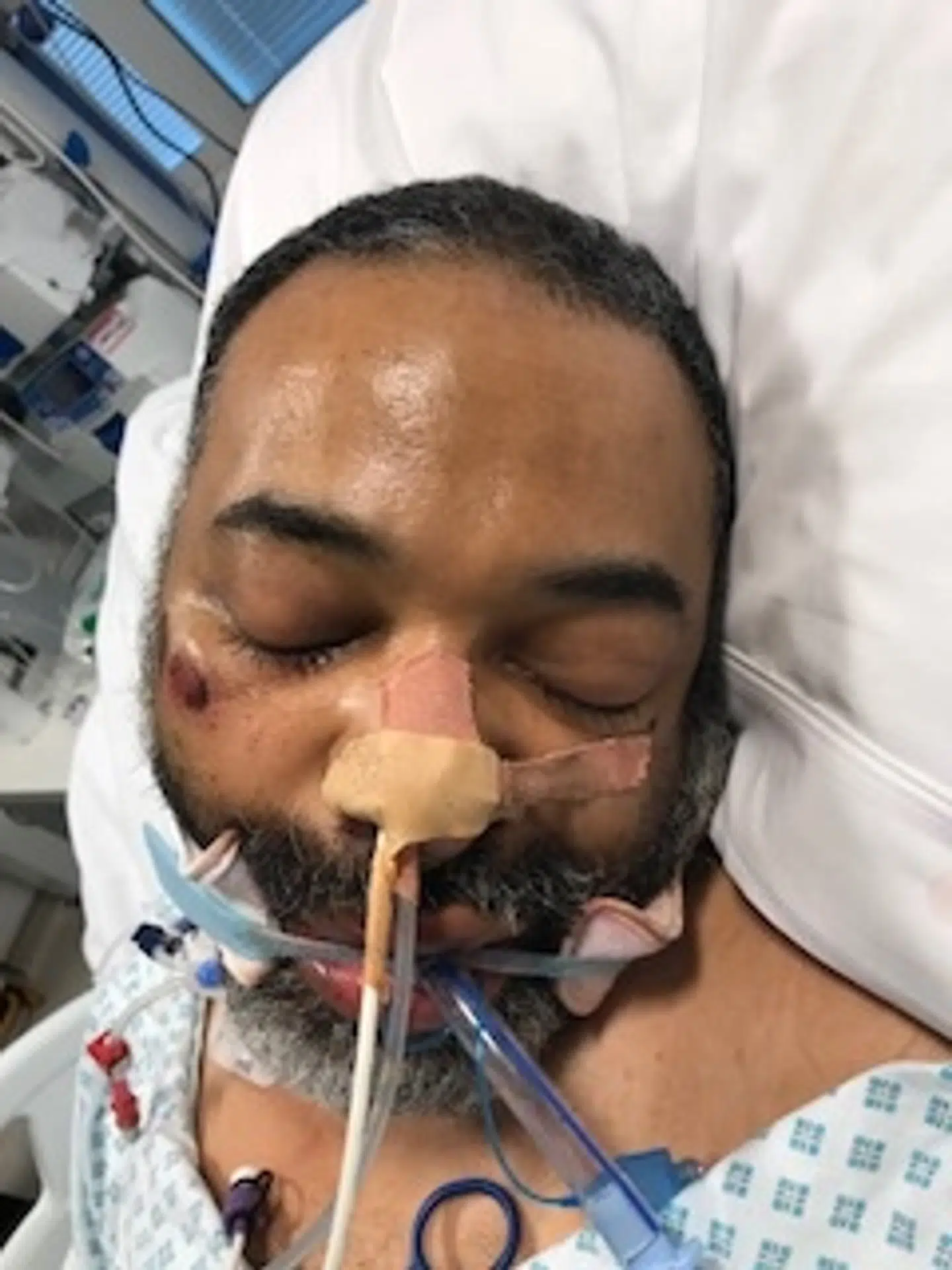 Sådan så billedet, der blev offentliggjort umiddelbart efter, manden blev bragt på hospitalet, ud.