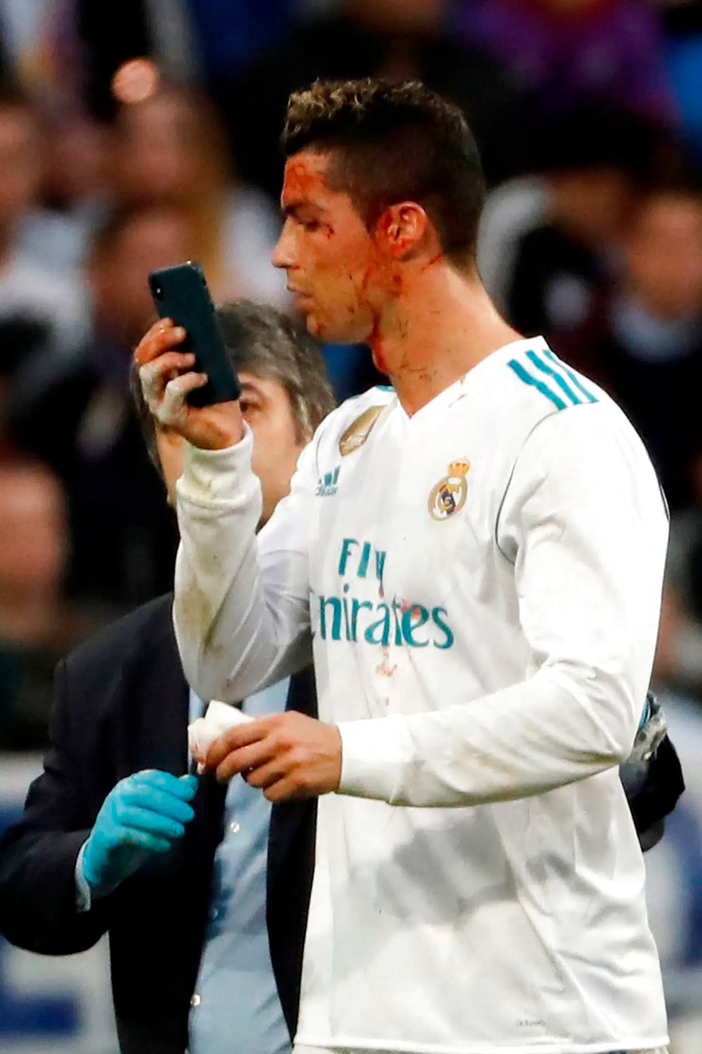 Cristiano Ronaldo besigtiger sin hovedskade i slutningen af kampen mellem Real Madrid og Deportivo La Coruña.