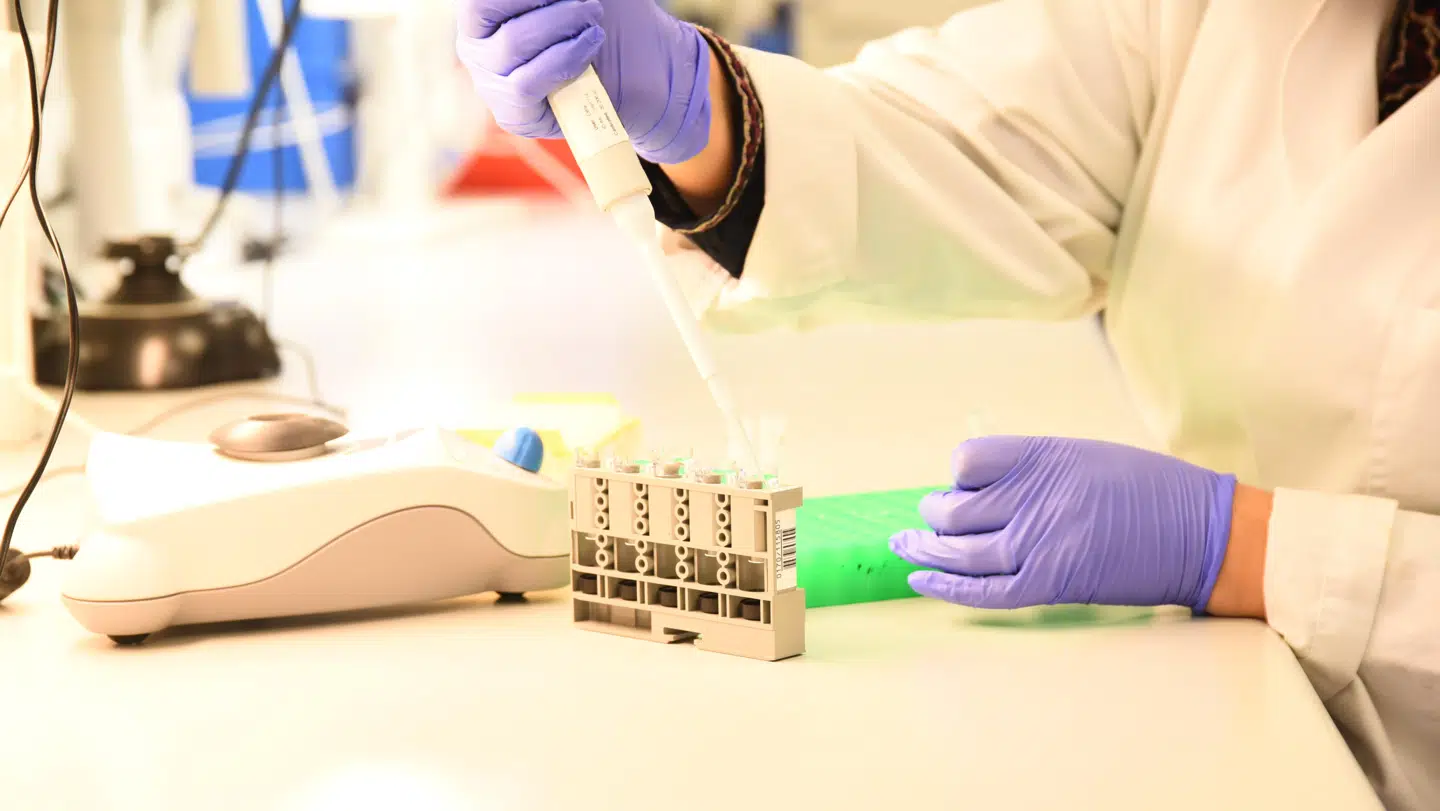 BioPorto blev etableret i 2000. Det skete med en plan om at udvikle og kommercialisere antistoffer. Som årene gik ændrede fokus sig gradvist, så BioPortos fokus også var på udvikling af nye biomarkører. Det var ifølge selskabet selv en udvikling, der accelerede, da selskabet begyndte at undersøge NGALs egenskaber som biomarkør. I 2013 omstillede BioPorto virksomheden til udvikling af diagnostiske tests.