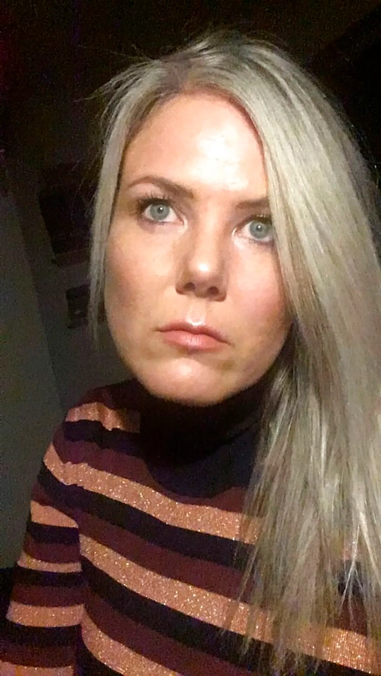 Stine Lykke Madsen blev i juni påkørt af en ung mand på et elløbehjul, som kørte modsat køreretningen på cykelstien og endte med at torpedere hende med et grimt styrt til følge.