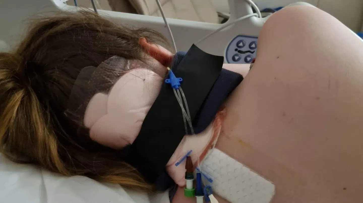 Sådan så Cecilie Hildebrandts nakke ud, efter operationen.