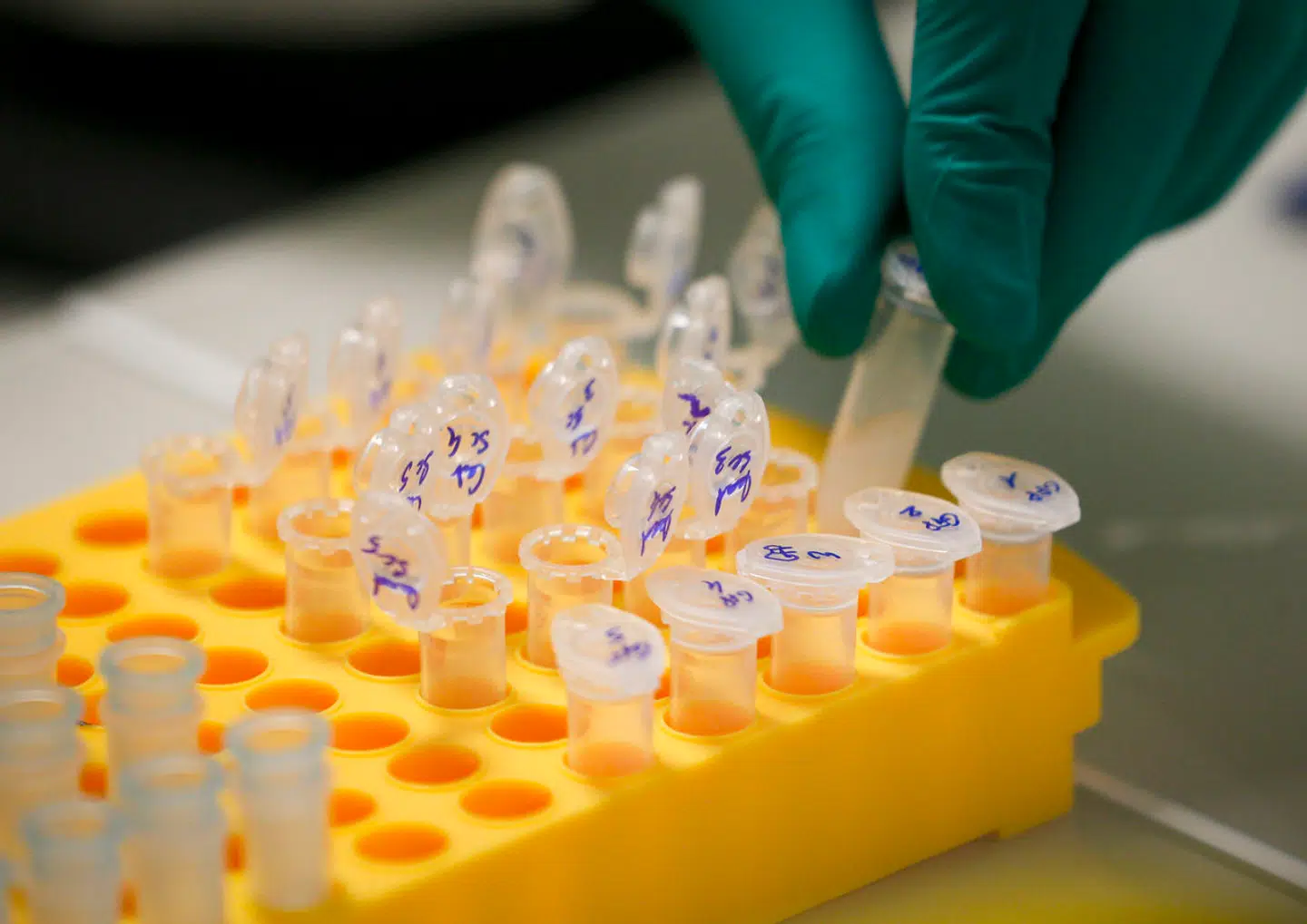 Et tættere samarbejde om sundhed i EU ville betyde, at lande som Danmark ikke længere skal have dårlig samvittighed over ikke at uddanne specialister til sygdomme, hvor der pga. vores lave befolkningsantal, kun er et tilfælde hvert tiende år, skriver Monika Rubin og Bergur Løkke Rasmussen.