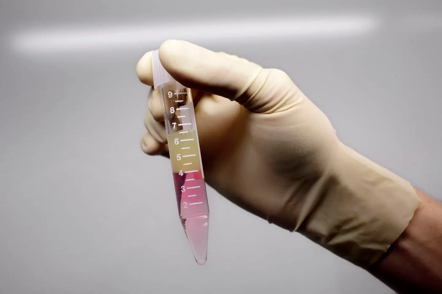 I laboratoriet bliver sæddonationerne renset. De sunde sædceller bliver med forskellige væsker filtreret fra de døde og andre ubrugelige rester fra sæden.