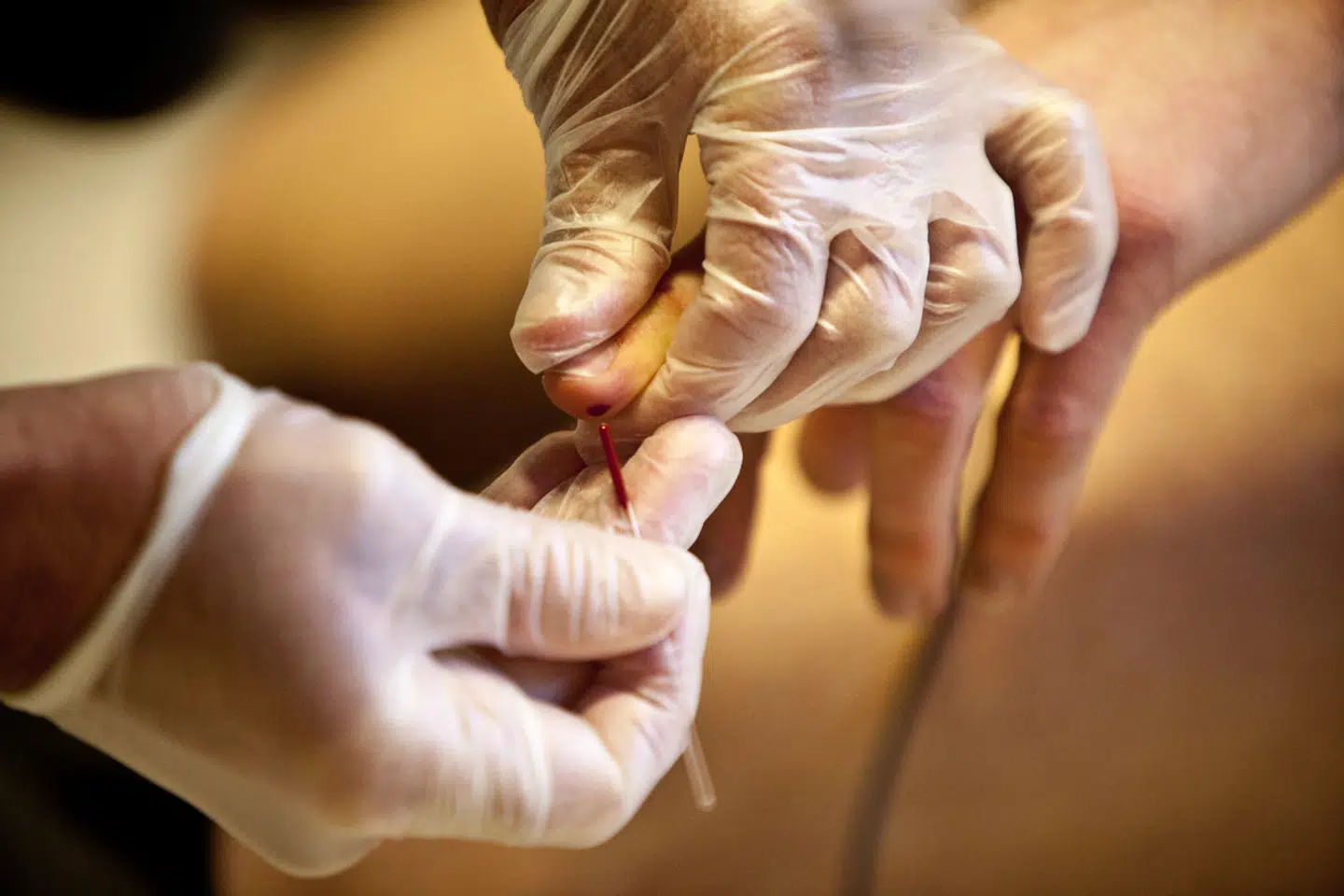 I USA og Storbritannien bliver der gennemført store projekter med det formål at afprøve test af hele arvematerialet hos 100.000 mennesker, hvilket koster omkring en milliard kroner. Med en ny metode vil danske forskere lave et tilsvarende studie med 300.000 personer til en brøkdel af prisen, påpeger professor Kjeld Schmiegelow fra Rigshospitalets Afdeling for Børn og Unge, der leder projektet.