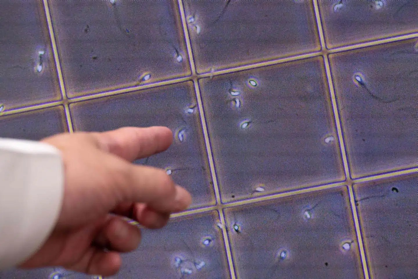 Forældre i fertilitetsbehandling med fremmede kønsceller kan selv vælge, om de ønsker en ikke-anonym eller anonym donor, og ligeledes kan donor selv til- eller fravælge anonymitet. (Arkivfoto.) – Foto: Yuichi Yamazaki/Ritzau Scanpix