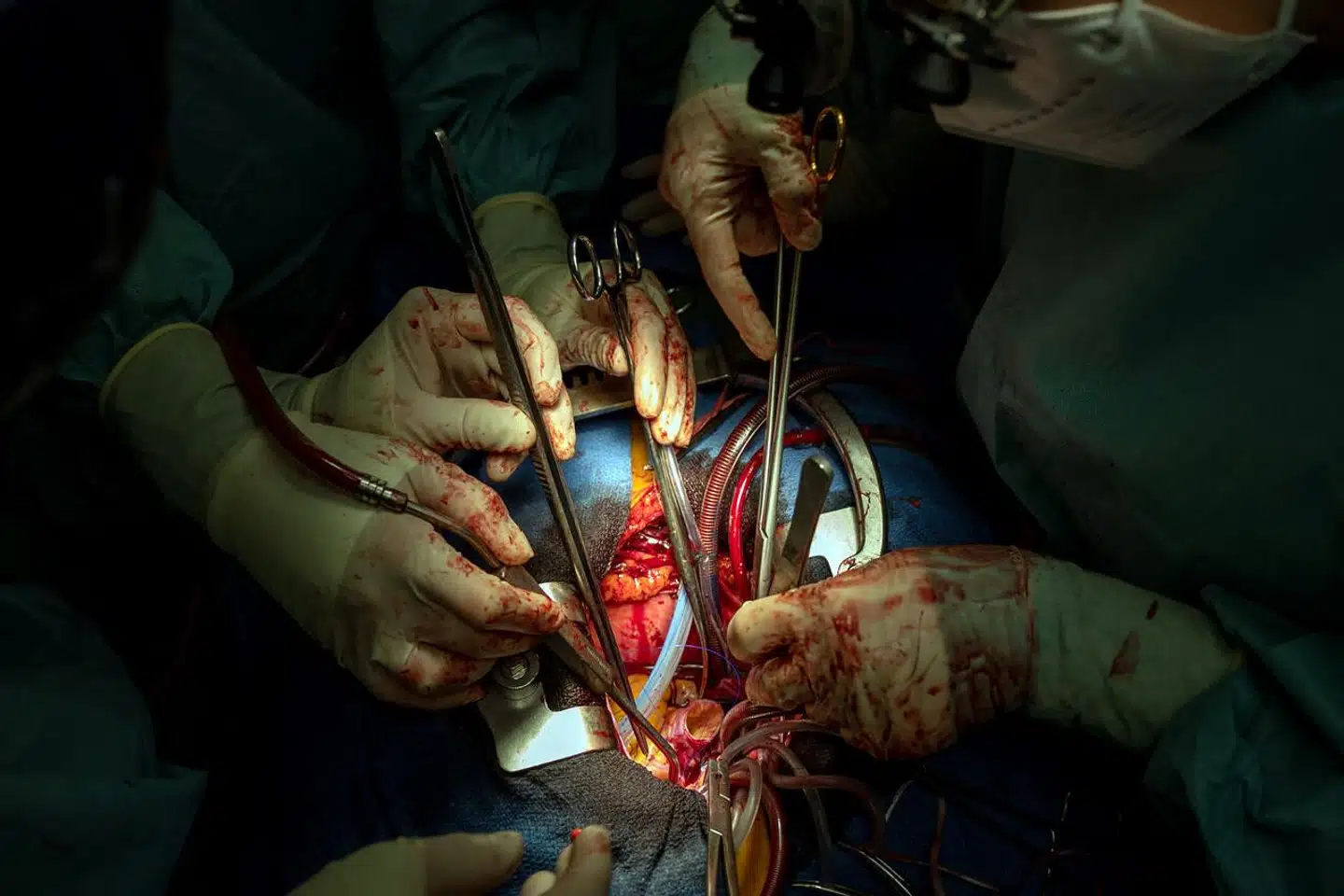 »Udover at staten ikke ejer dine organer, så er det heller ikke statens opgave at tvinge dig til at tage et så eksistentielt valg, hvilket det vil være for nogen,« skriver Christian Holst Vigilius.