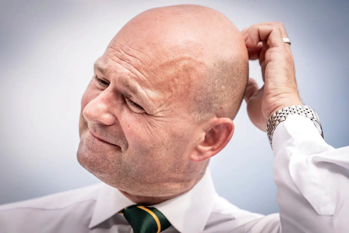 Når De Radikale med rette kritiseres for en bevidstløs og helt uigennemtænkt udvidelse af den offentlige sektor med 20.000 ansatte, må man også kritisere De Konservative for at finansiere deres 2030-plan med en grønthøster, skriver Thomas Bernt Henriksen i denne leder.