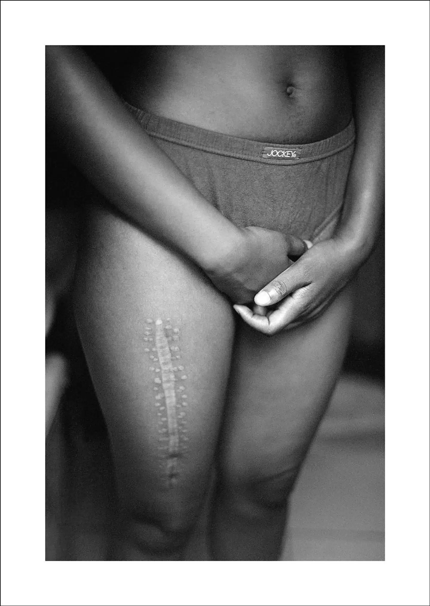 »Aftermath« er fra Zanele Muholis første serie, »Only Half The Picture« fra 2002-2006. En sårbar, sart og blidt fotograferet serie i sort/hvid med et tungt indhold om mennesker, der har overlevet hadforbrydelser i sydafrikanske townships.