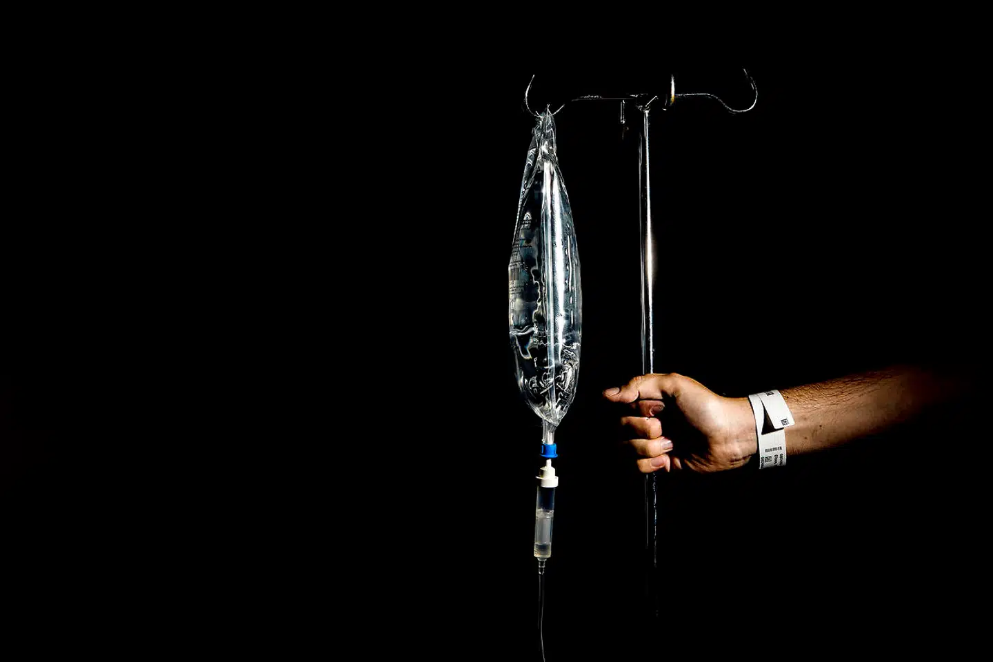 Ventelisterne til operationer på landets hospitaler voksede støt under coronapandemien, fordi meget måtte udskydes. Men ifølge Danske Regioner er det ikke kun pandemien, der bærer skylden. Det gør også sygeplejerskestrejken, der fandt sted sidste år, og mangel på personale på hospitalerne.