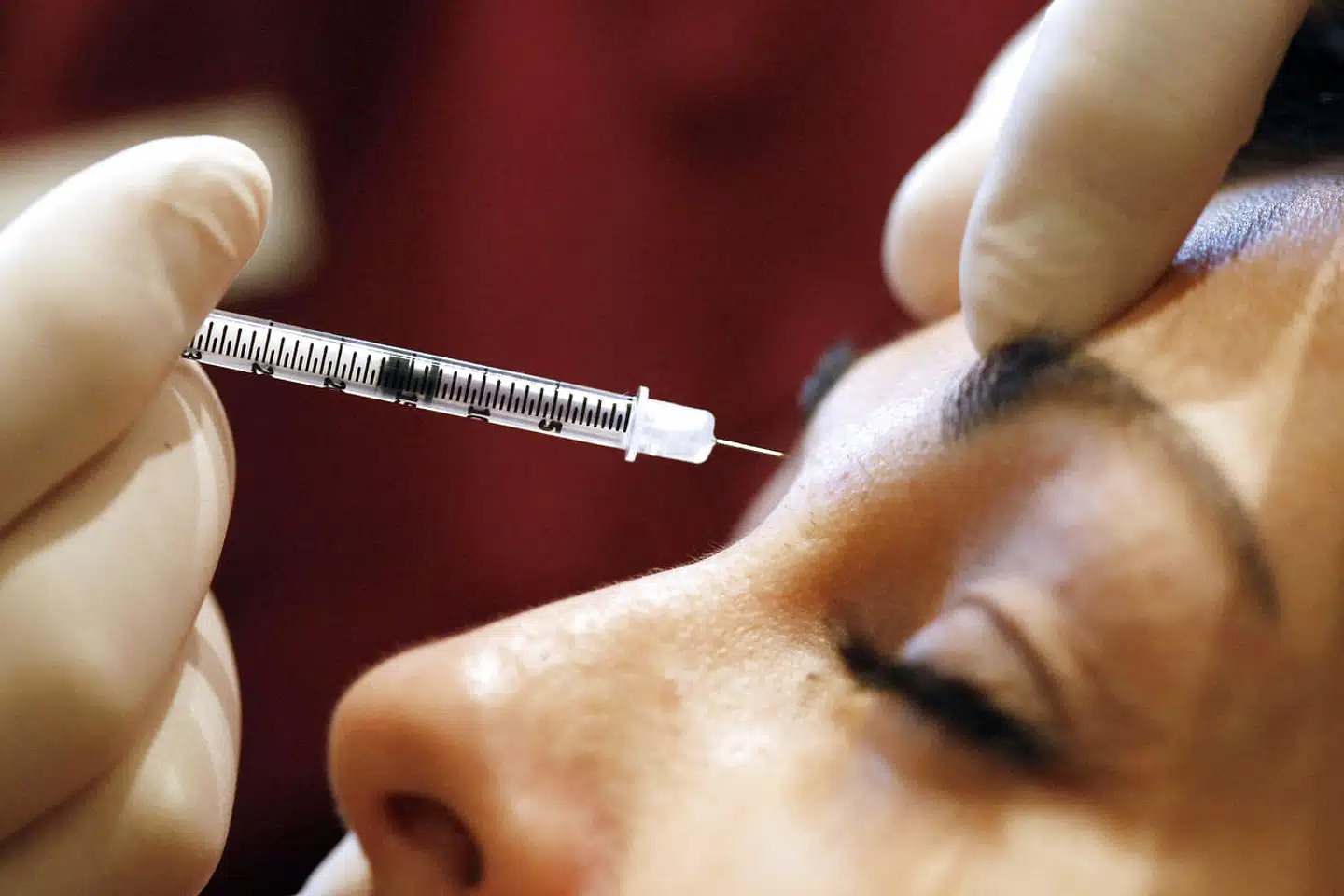 Fordommene lever i bedste velgående, når det gælder kosmetiske indgreb. Paradoksalt nok vælger et stigende antal danskere at få noget lavet. Det skaber beskyldninger, løgne og fortielser.