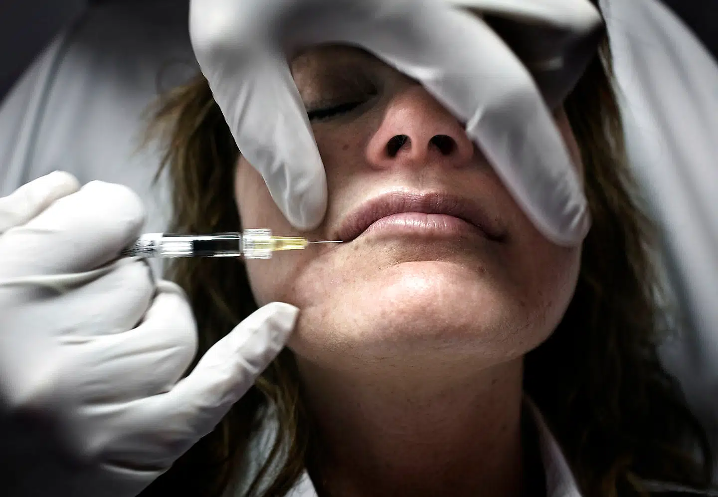 Det naturlige ændrer sig, så nogle kosmetiske indgreb i dag er fuldt accepterede – men ikke alle!