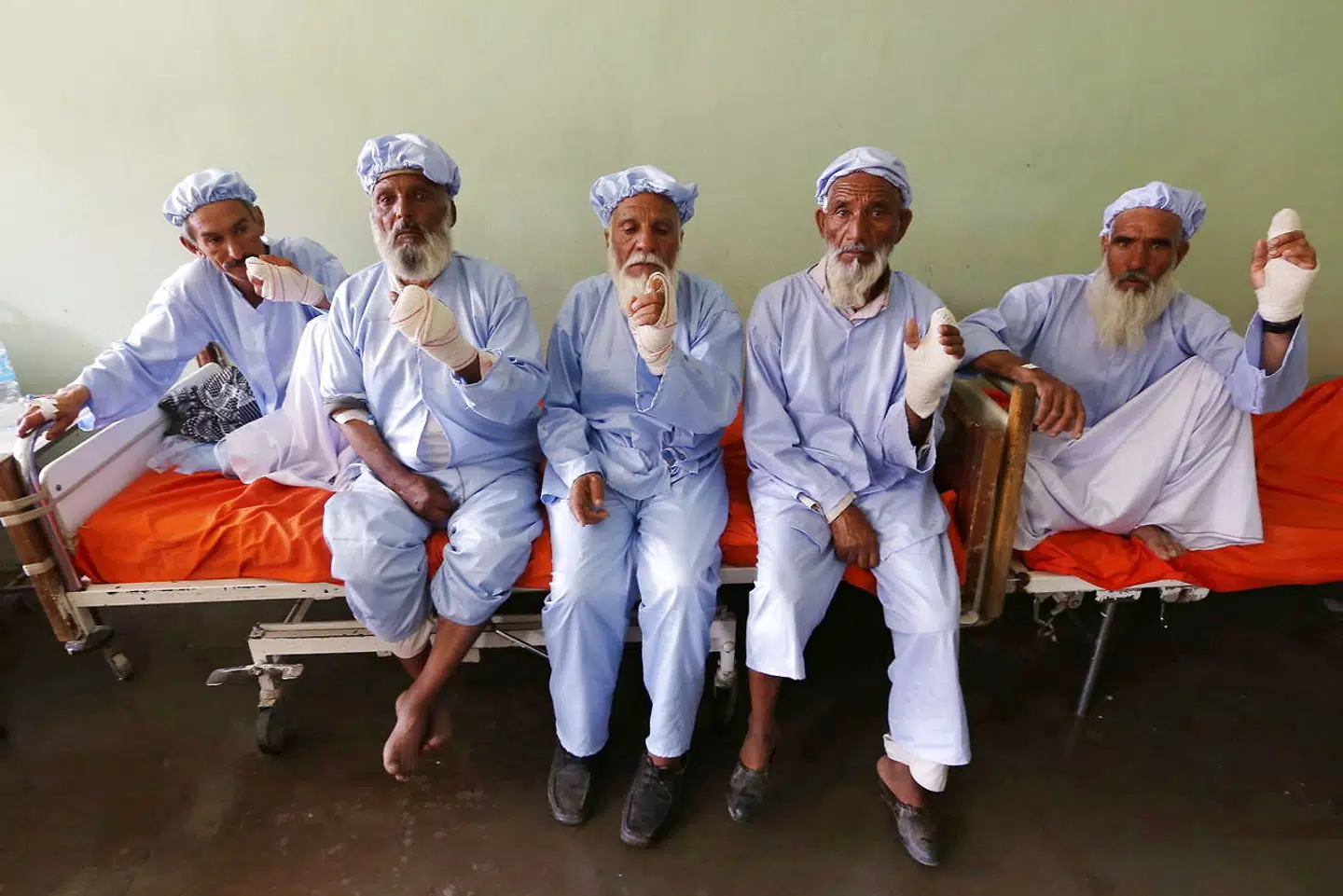 Et billede af Talibans brutalitet. Disse mænd havde deltaget i et frit valg ved med blæk at sætte deres fingeraftryk på en stemmeseddel. Taleban straffede dem med at afhugge fingre med blæk på. Billedet er fra juni 2014, hvor mændene var indlagt på et hospital i Herat.