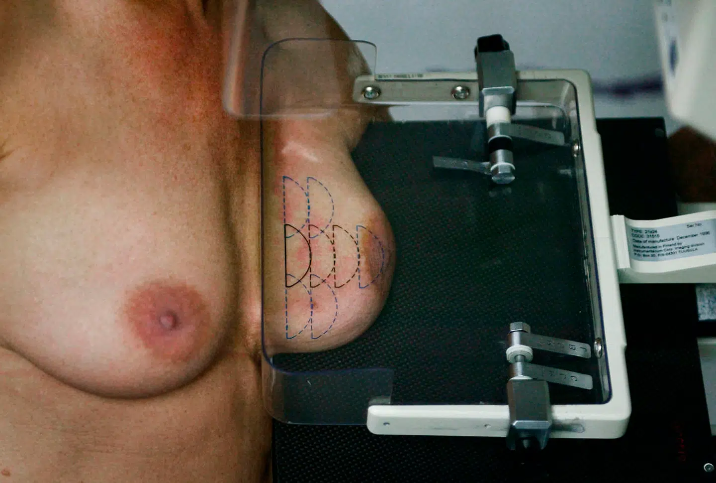 Kvinder i hovedstaden med tegn på brystkræft kan i øjeblikket risikere at komme til at vente over tre uger på at få en tid til klinisk mammografi, der skal vise, om de har sygdommen eller ej. Ifølge reglerne må de højst vente 14 dage.