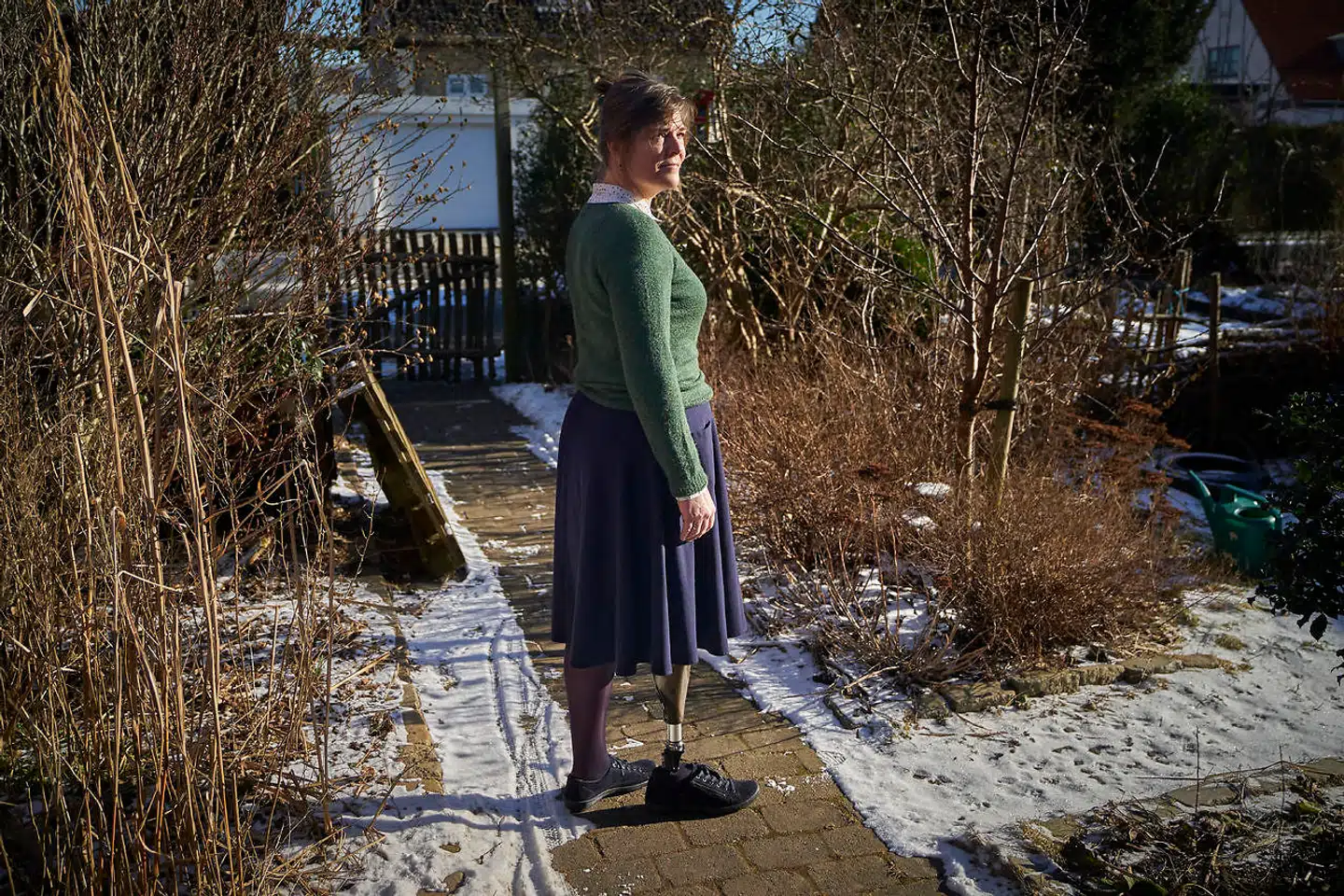 »Jeg søgte for otte år siden om en langt bedre protese, men jeg fik den først efter et år med et psykisk hårdt forløb med en efter min mening kritisabel sagsbehandling og usaglige afslag,« skriver Ea Eskildsen i denne kronik, hvor hun langer ud efter sagsbehandlingen af hjælp til handicappede i kommunerne.