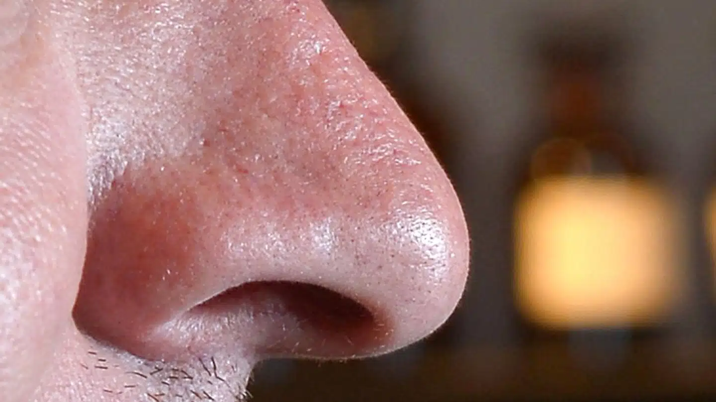 Manglende smags- og lugtesans er et typisk symptom på infektion med covid-19.