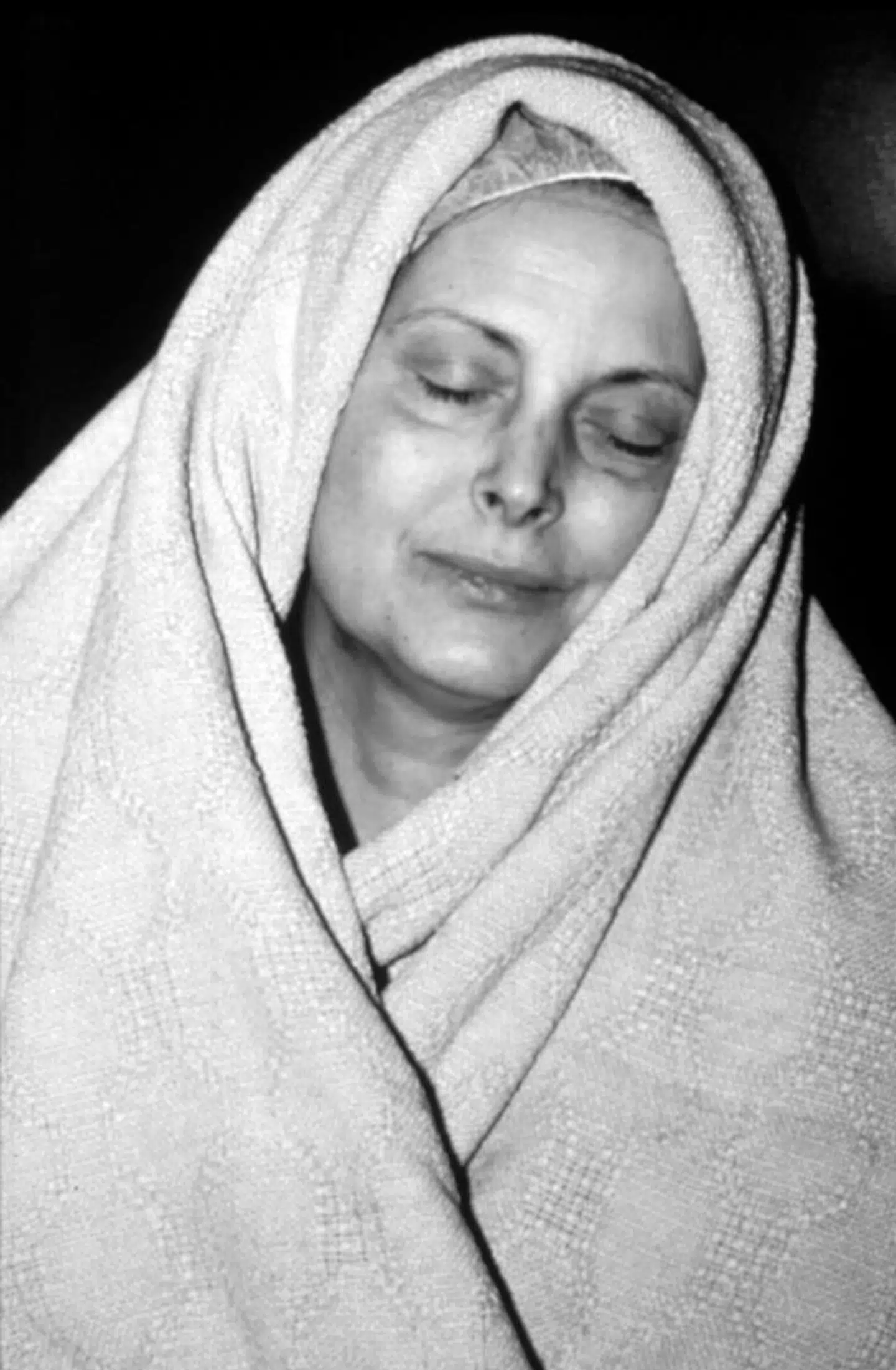 Den amerikanske kunstner Hannah Wilke brugte sig selv og sin alvorlige kræftsygdom i sine værker.