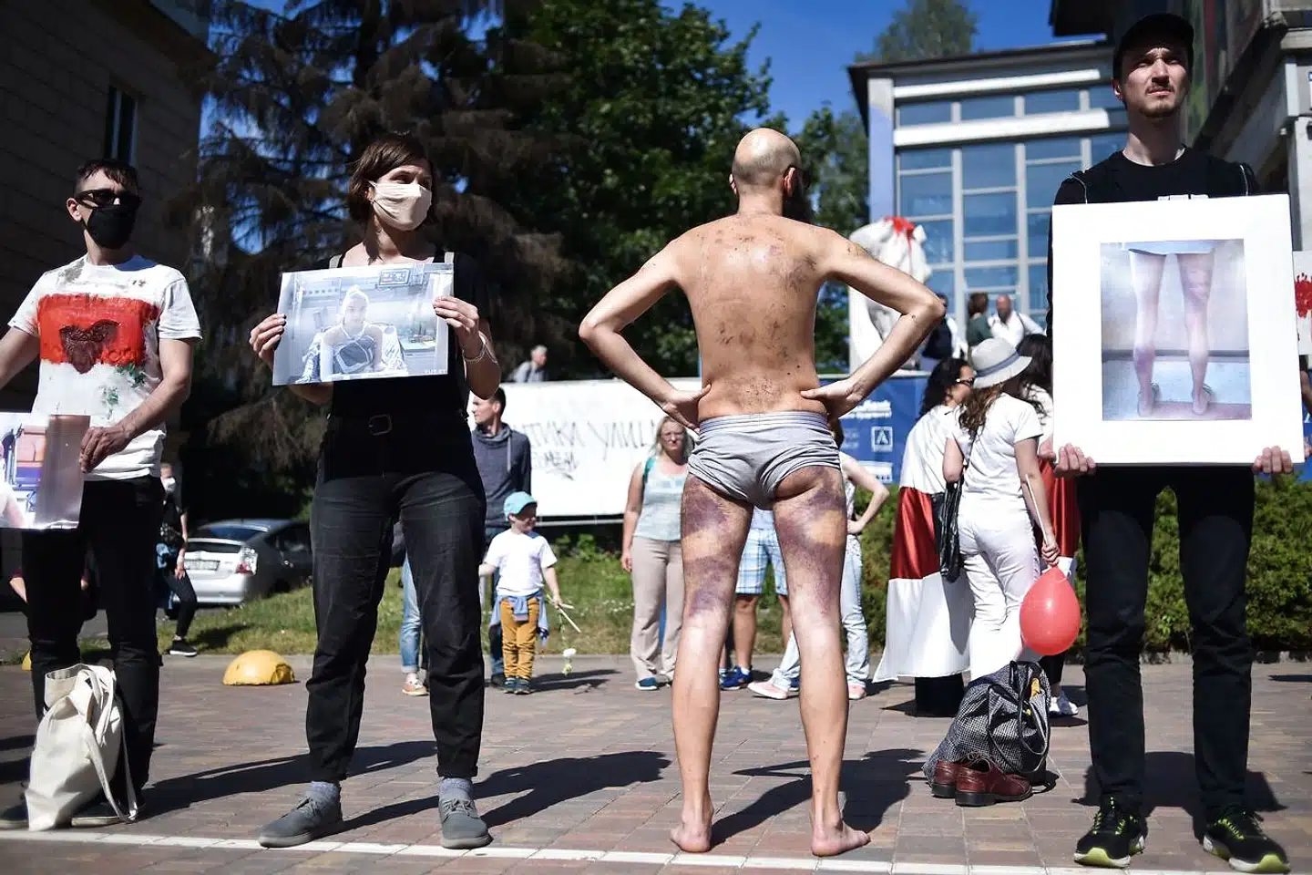 En demonstrant viser sine skader efter de voldsomme demonstrationer i Hviderusland, mens andre viser billeder af demonstranter, som er blevet tæsket. Det foregår under en demonstration lørdag 15. august, nær Pushkinskaya metrostation, hvor 34-årige Alexander Taraikovsky døde.
