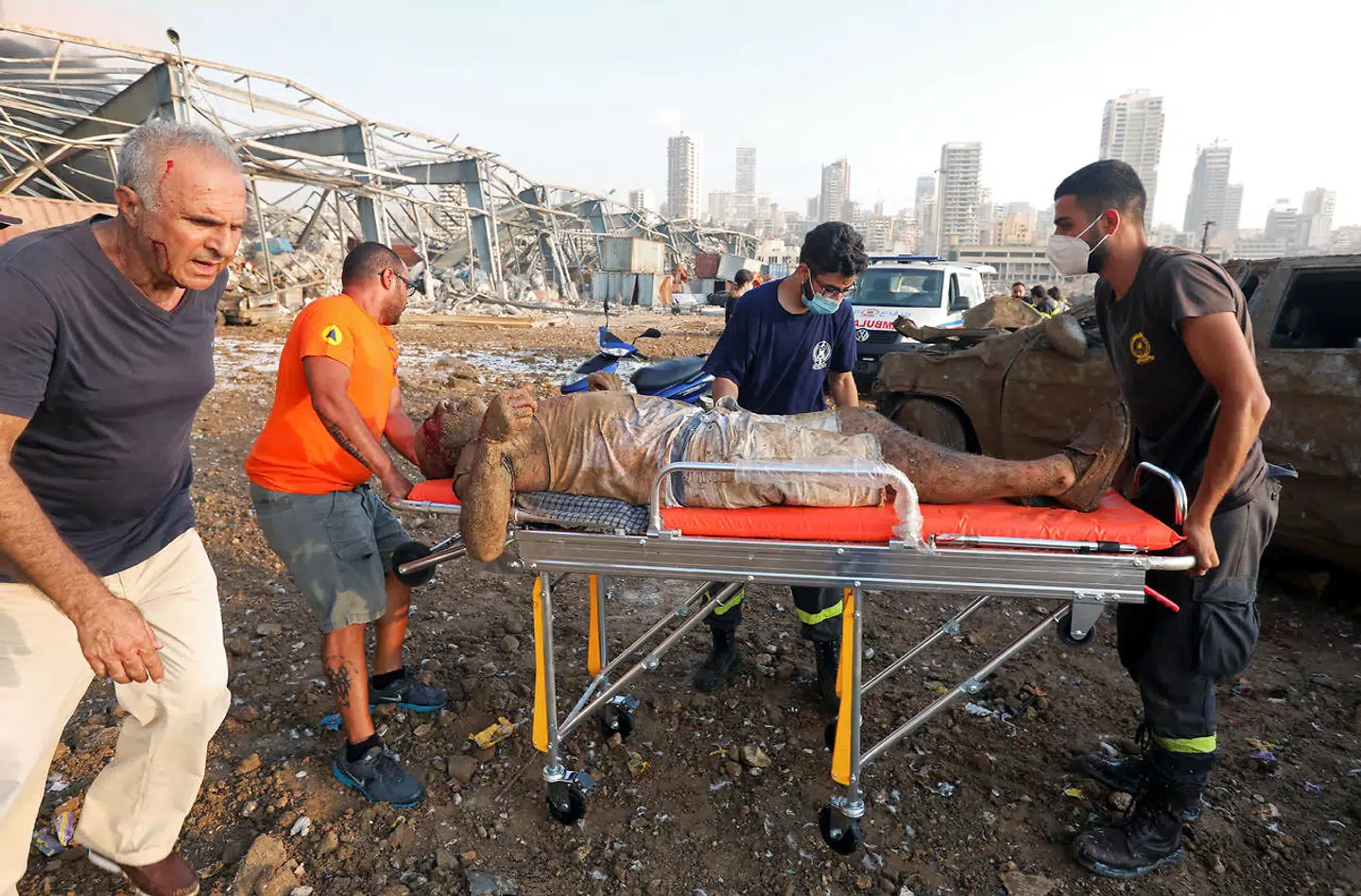 Der var kaos i Beirut i timerne efter eksplosionen. Redningspersonel kæmpede for at hjælpe de sårede, mens hospitalsansatte på Beiruts hospitaler kæmpede både med ødelæggelser på hospitalerne og en stadig strøm af kvæstede.