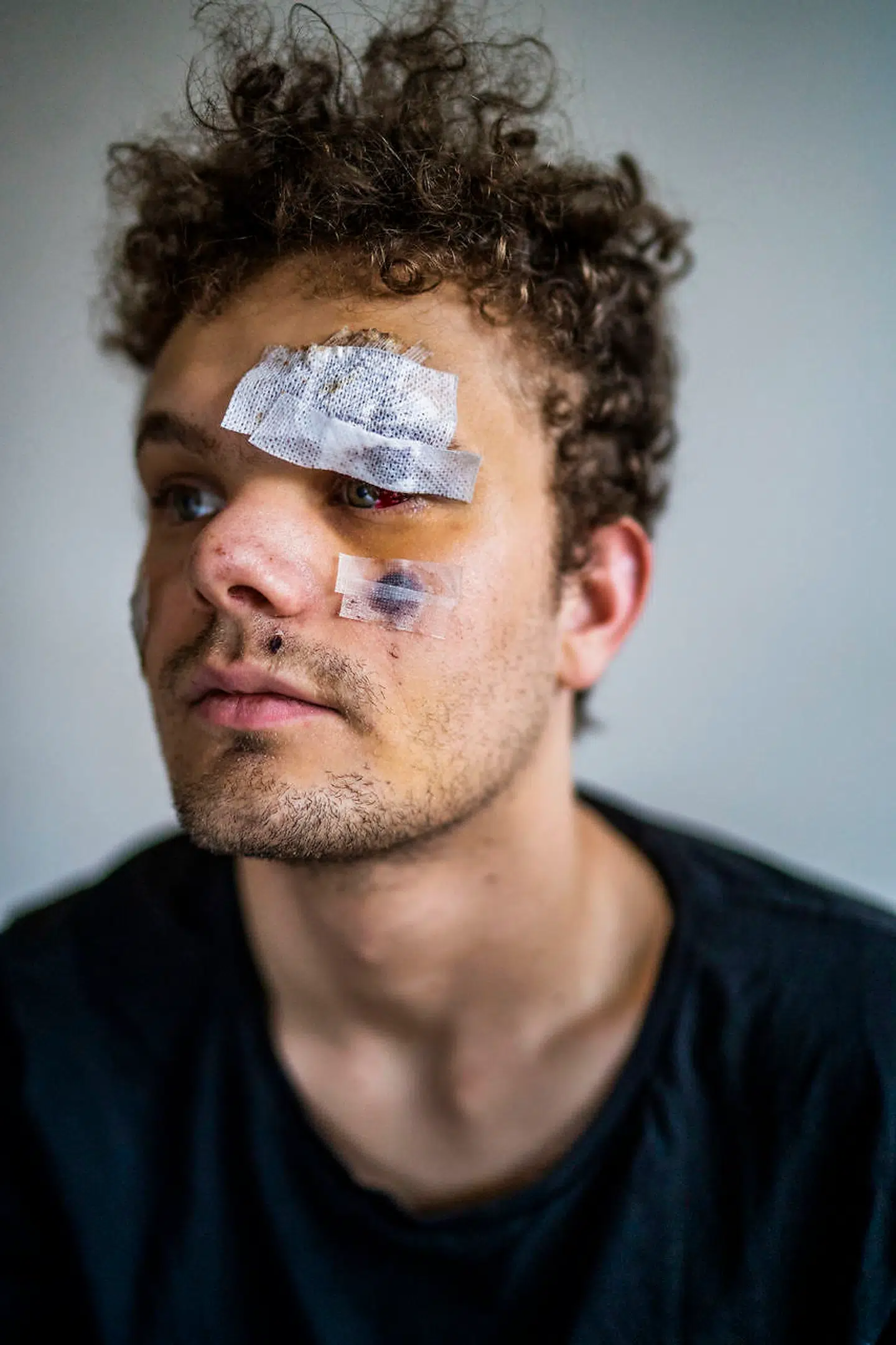 »Jeg gik i panik, da jeg vågnede på hospitalet. Det første, jeg ser, er, at der er blod overalt på min hovedpude. Jeg vidste ikke, hvor jeg var, eller hvorfor jeg var der,« sagde Lauritz Lindboe Wind, da Berlingske første gang talte med ham om overfaldet.