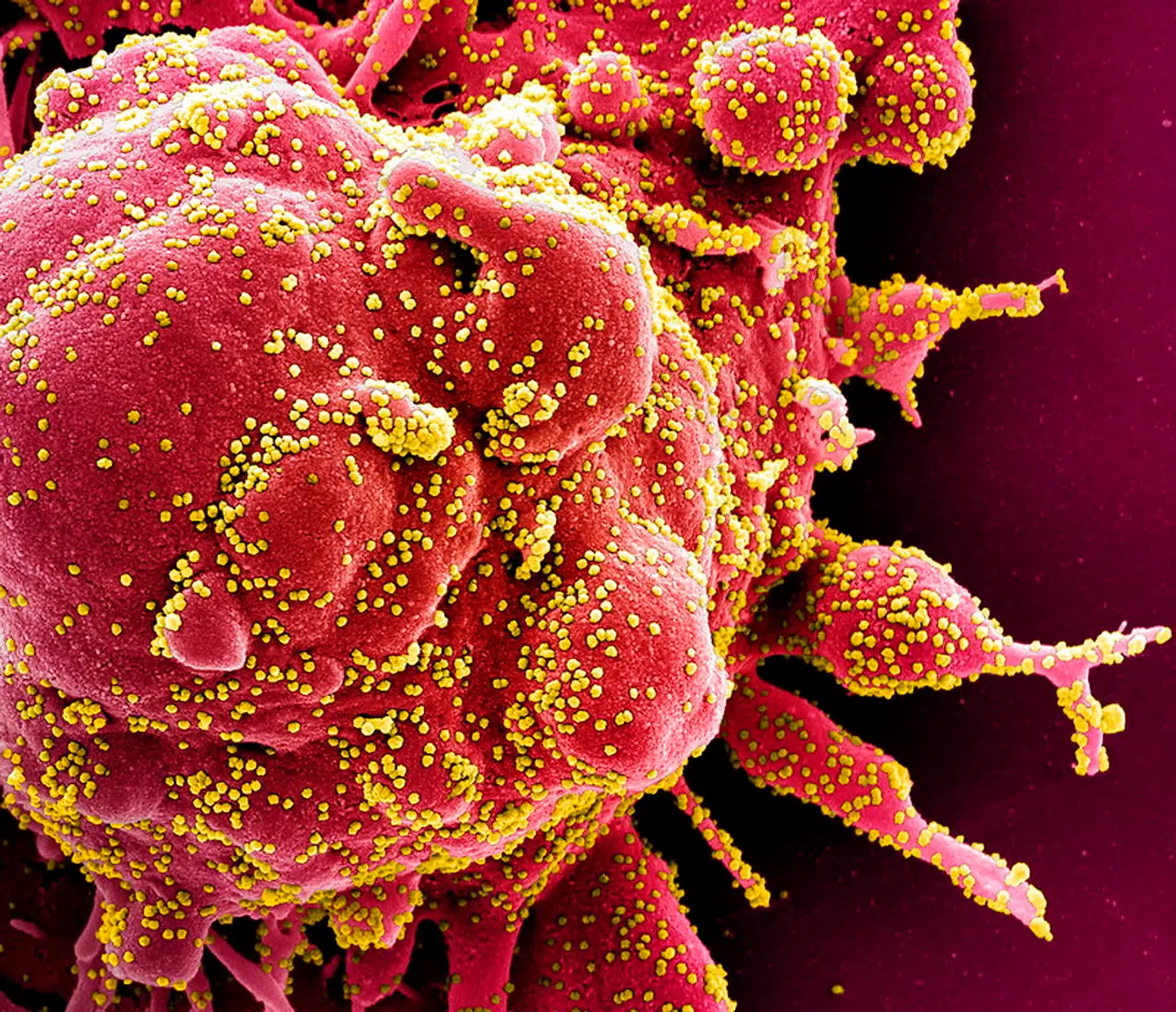 Et farvelagt mikrofoto fra USAs National Institute of Allergy and Infectious Diseases (NIAID) viser en celle under angreb fra gule SARS-CoV-2-partikler.