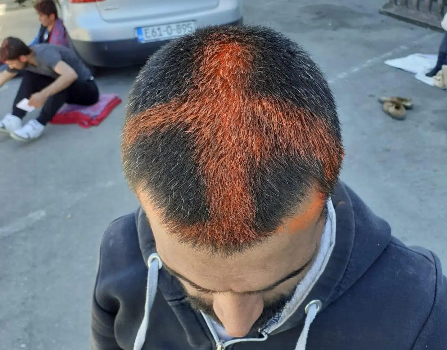 33 flygtninge og migranter forklarer, at de blev banket og fik malet kors på hovedet af det kroatiske politi, før de blev presset tilbage over grænsen til Bosnien.