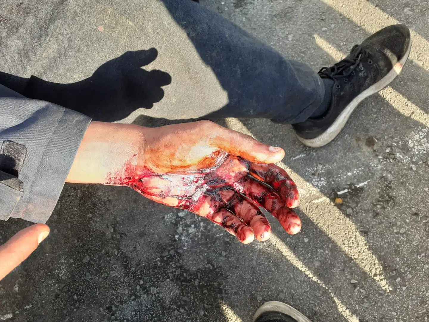 Flere af migranterne blev skåret i håndfladerne med en kniv.