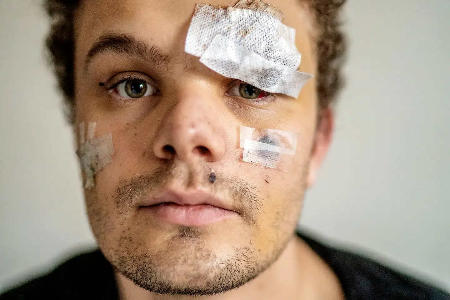 Lauritz Wind der blev overfaldet i Gothersgade.