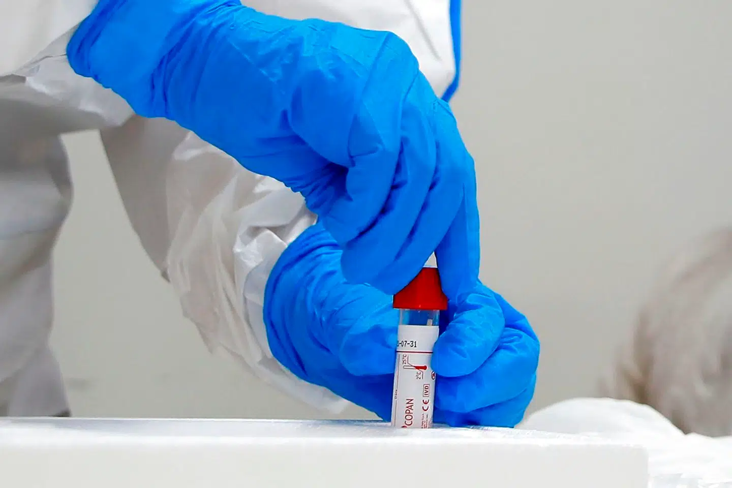 En antistoftest kan påvise, om man tidligere har været smittet med coronavirus. I blodet kan man måle tilstedeværelsen af antistoffer, som kroppen danner efter sit møde med virussen. Antistofferne fungerer som et forsvarsværk mod virussen, og den nuværende viden peger på, at det betyder, at man ikke kan blive smittet med samme virus igen.