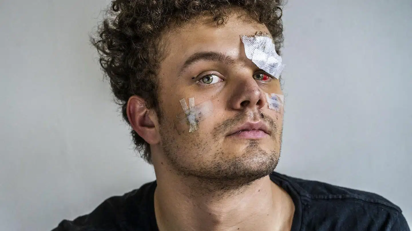 Lauritz Wind blev overfaldet på Gothersgade.