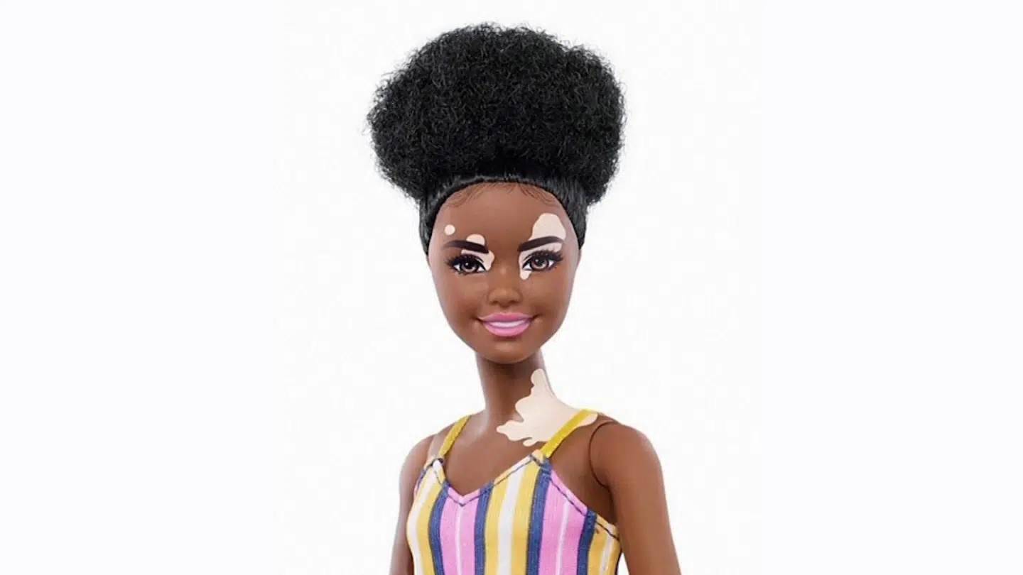 Vitiligo-dukken er designet, så at den ligner personer med pigmentforstyrrelse.