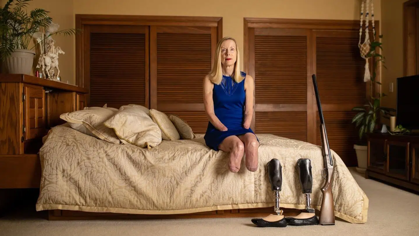 Julie Dombo mistede begge hænder og fødder efter et røveri i 2015. Nu lever hun med proteser på både hænder og fødder. Alligevel forsvarer hun retten til at bære våben, selv om hun ikke længere selv kan.