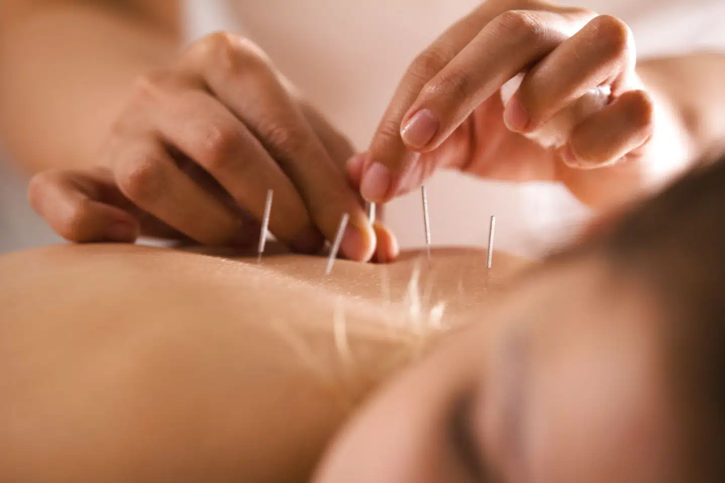 »Du kan sagtens forklare, at store analyser har vist, at akupunktur er virkningsløst, og at der ingen effekt er udover placebo. Men det klassiske svar er: »Jamen, jeg fik det altså bedre alligevel, så det må virke.«