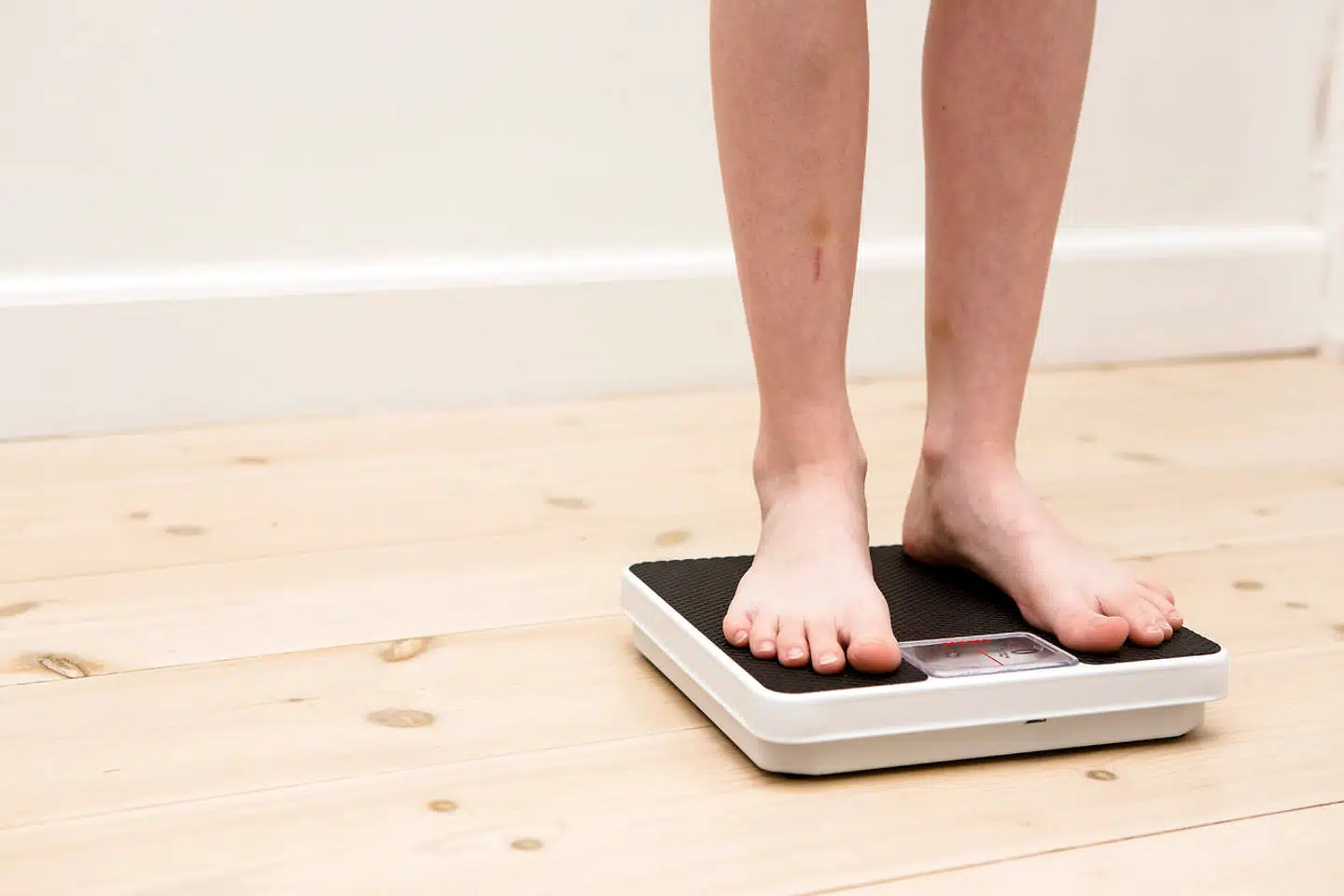 Noget tyder på, at lidt flere fra de socioøkonomisk højere lag bliver ramt af anoreksi.