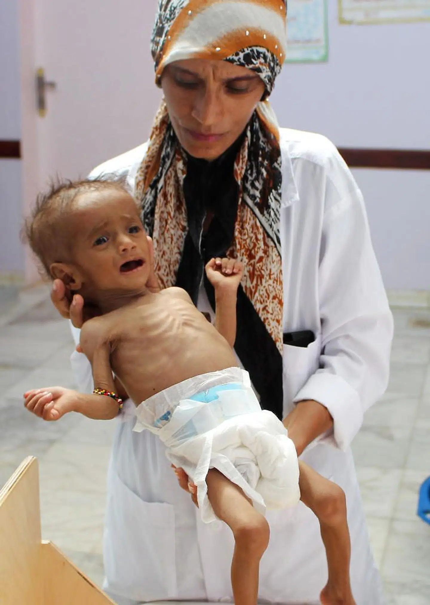 En sygeplejerske i Yemen med et af de mange tusinde svært underernærede børn i det krigshærgede land.