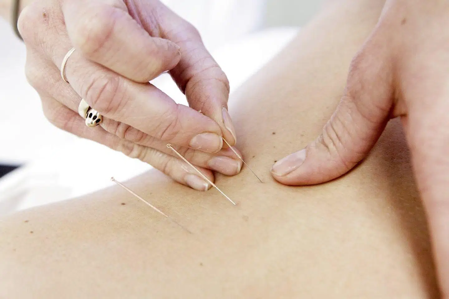 Patienter, der benytter alternative behandlere, er efterladt i et retssikkerhedsmæssigt tomrum. Foto: Flemming Krogh/Ritzau Scanpix