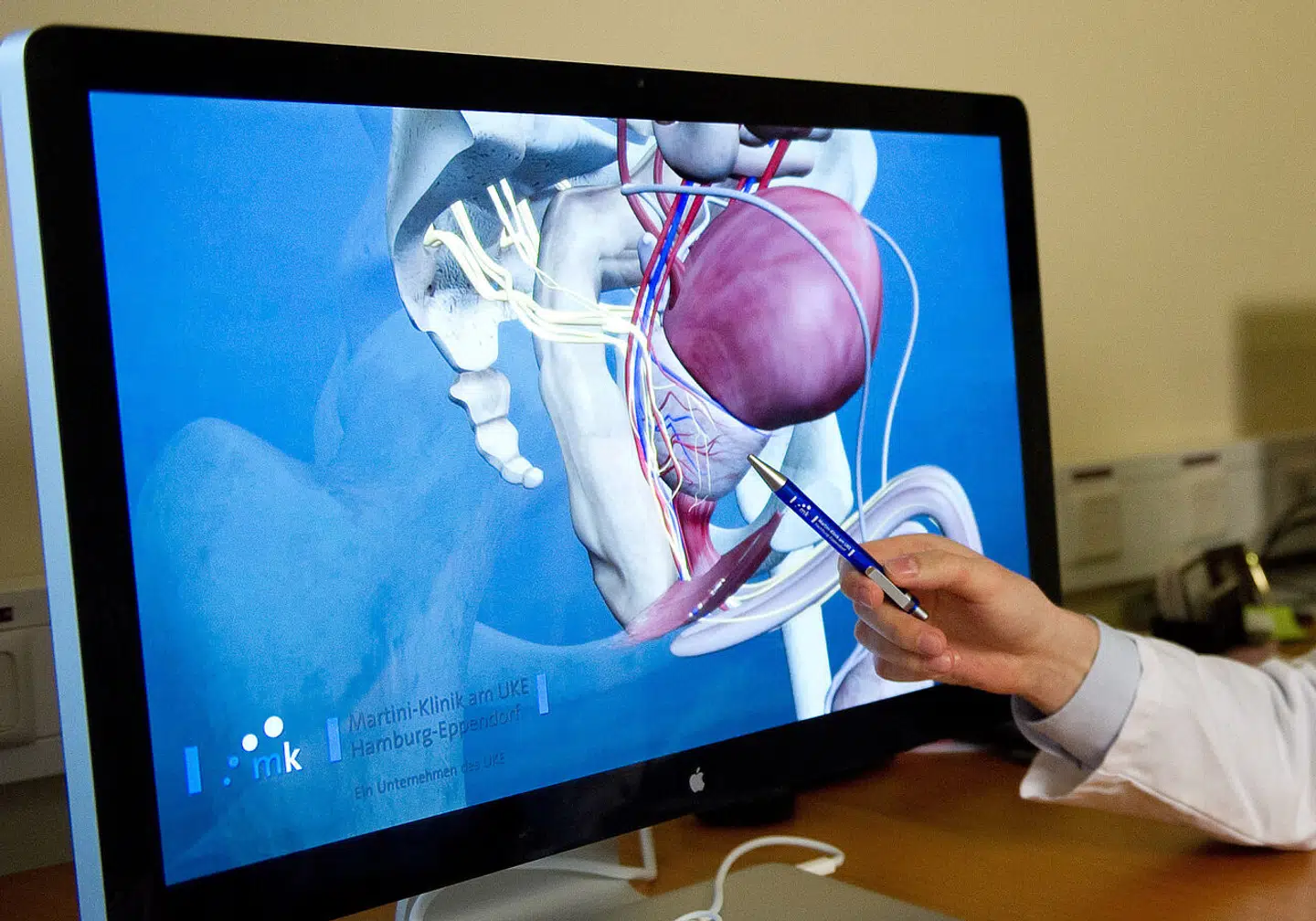 »Tidlig opsporing af prostatakræft er vejen frem for at sikre, at antallet af mænd med prostatakræft opdages i tide,« skriver Svend Krogh.